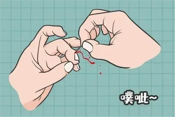 倒刺可以撕吗，倒刺拔了会怎么样