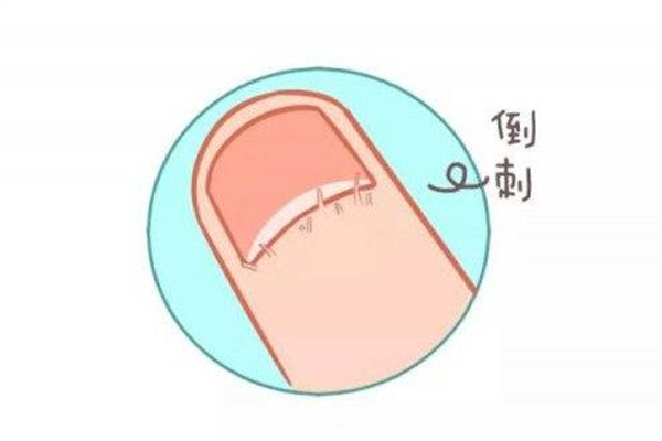 手长倒刺涂护手霜有用吗，手上倒刺涂什么比较好