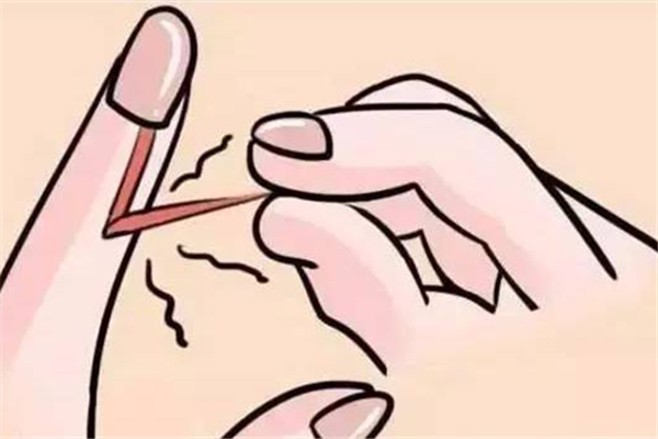 手长倒刺是什么原因造成的，手长倒刺是缺少什么维生素