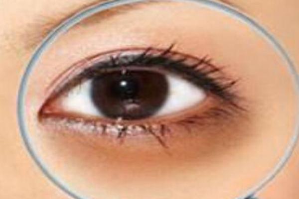 黑眼圈有天生的吗，黑眼圈有白色颗粒是什么
