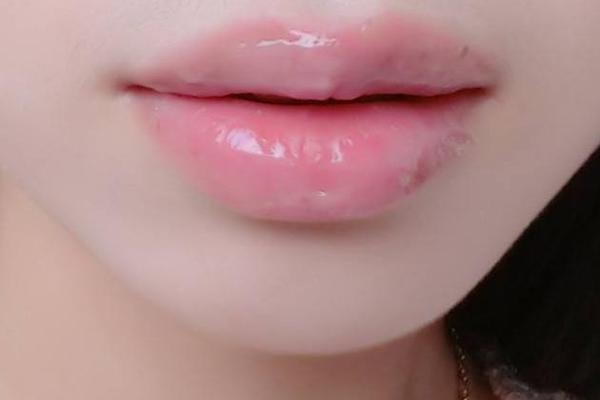 丰唇可以吃消炎药吗，丰唇吃什么食物