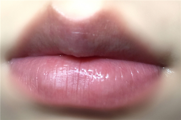 丰唇有硬块什么原因，丰唇硬块会消失吗