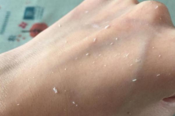 去角质对皮肤有伤害吗，去角质的作用与功效是什么