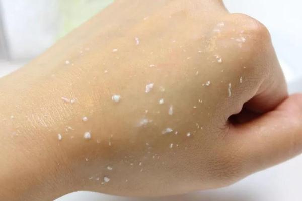 去角质的产品哪款好用，去角质对痘痘有用吗