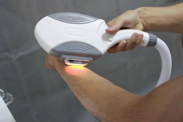 冰点脱毛会影响汗腺的排出吗，冰点脱毛会伤害皮肤吗