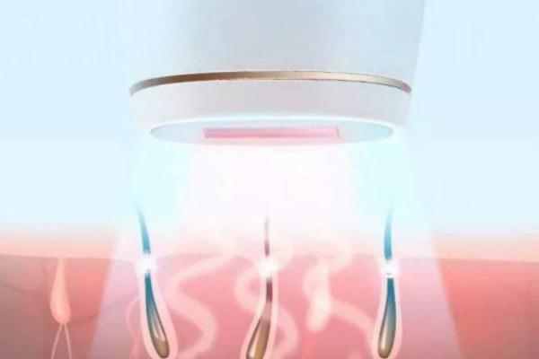 激光脱毛的注意事项，激光脱毛的副作用有哪些