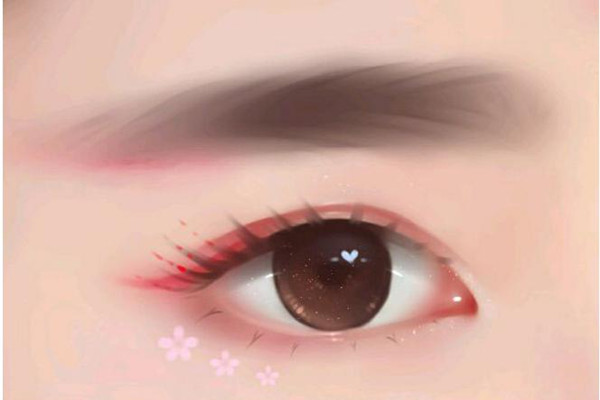 开眼角后多久能化妆，开眼角后几天拆线