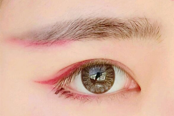 开眼角多久能恢复好，开眼角后怎么护理