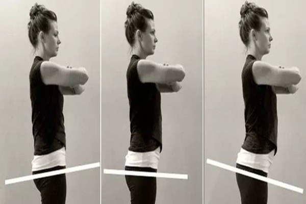 骨盆前倾怎么坐比较好，骨盆前倾要多久才能矫正