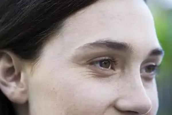 眼部细纹贴眼膜有用吗，眼部细纹是怎么造成的