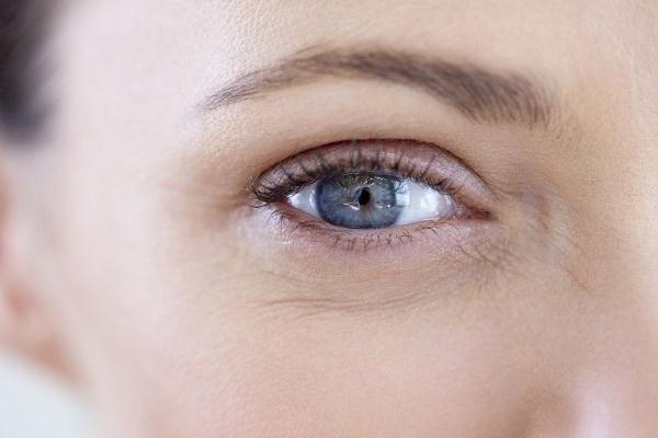 细纹是怎么产生的，细纹干纹怎么消除