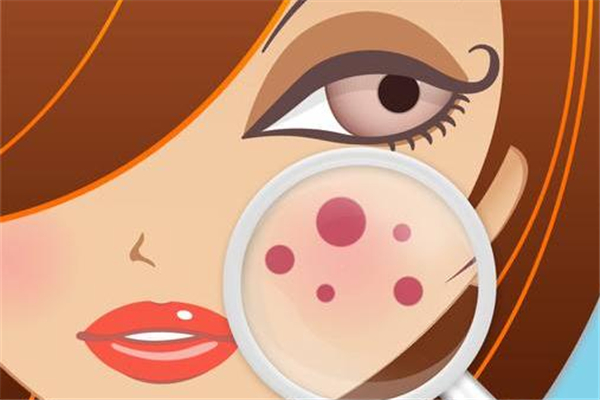 激光祛斑后可以敷面膜吗，激光祛斑后怎么护理恢复快