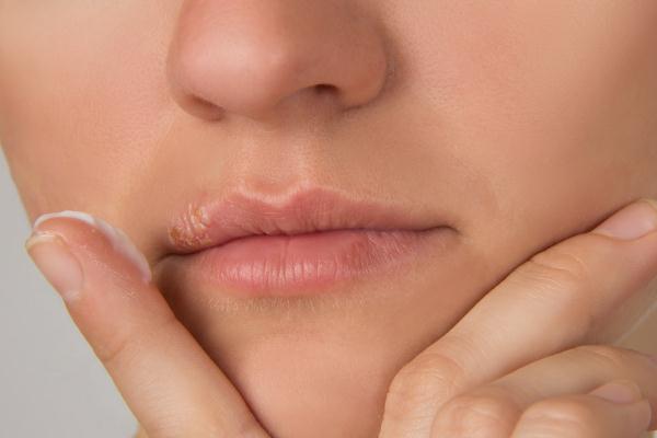 唇毛会自己慢慢消失吗，唇毛会自己脱落吗