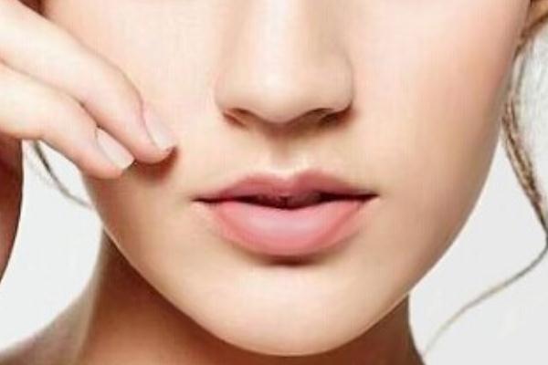 唇毛是脱毛好还是漂白好，唇毛是什么原因导致的