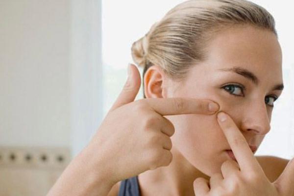 粉刺可以挑出来吗，粉刺可以自己挤吗