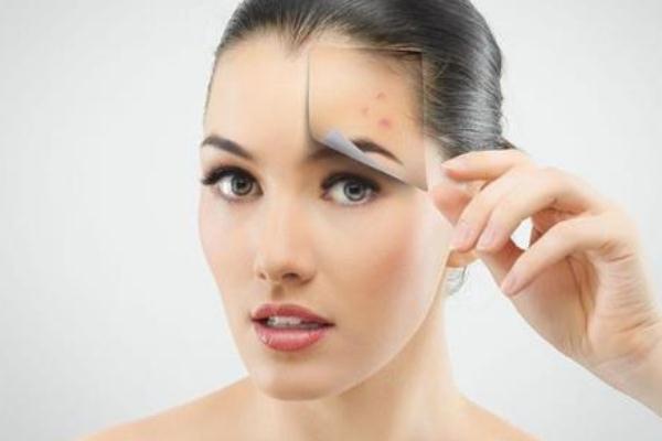 粉刺有硬块但是挤不出来怎么办，粉刺会传染给别人吗