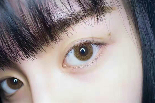 美瞳过期了还能继续戴吗，美瞳过期戴上会有什么异样