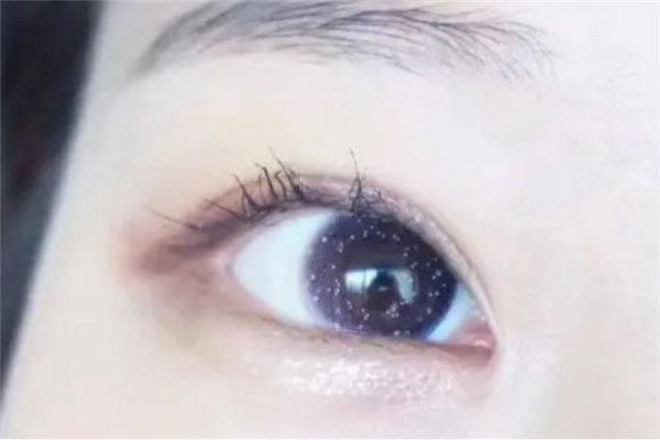 美瞳买回来可以直接佩戴吗，美瞳买回来后怎么处理