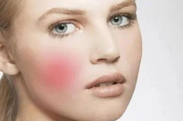 敏感肌要用清洁面膜吗，敏感肌会自己恢复吗