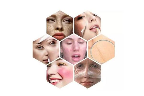 敏感肌肤的症状有哪些，敏感肌肤的特点