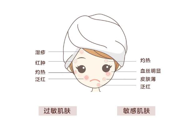 敏感肌怎样修复成正常肌肤，敏感肌肤适合什么牌子的护肤品