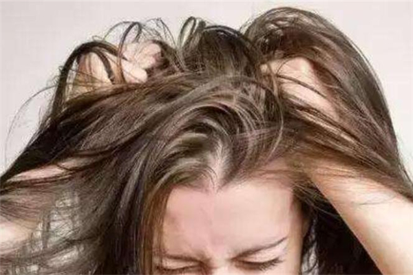 油性头发一天不洗就很油怎么办，油性头发一天洗两次合适吗