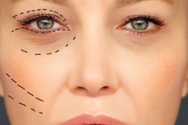 眼袋为什么有脂肪粒，眼袋为什么一个大一个小