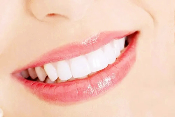 烤瓷牙用什么做的，烤瓷牙用什么材料好