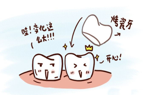 烤瓷牙是不是假牙，烤瓷牙是不是金属