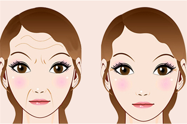 法令纹可以通过护肤品改善吗，面膜可以去除法令纹吗