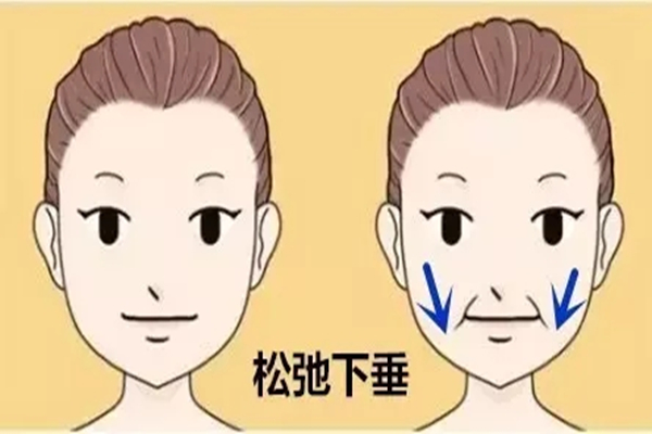 法令纹会遗传吗，法令纹跟什么有关系