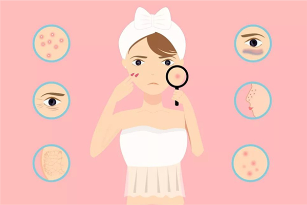 闭口和粉刺的区别，闭口和粉刺是一样的吗