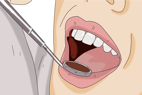 戴牙套能不能洗牙，戴牙套洗牙好吗