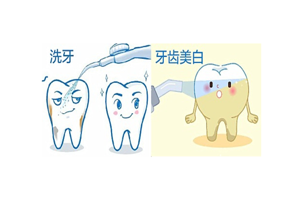 洗牙有必要吗，洗牙有什么作用
