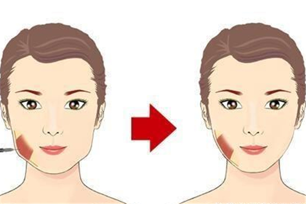 整容会失败吗，整容失败怎么维护自己的权益