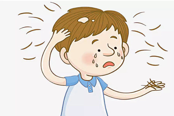 神经性脱发的症状表现，神经性脱发怎么调节