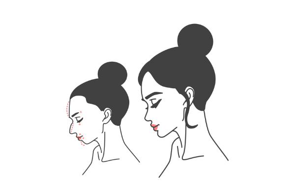 整容有什么后遗症，整容有风险吗