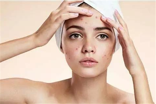 果酸换肤可以去鸡皮吗，果酸换肤适合哪些皮肤问题
