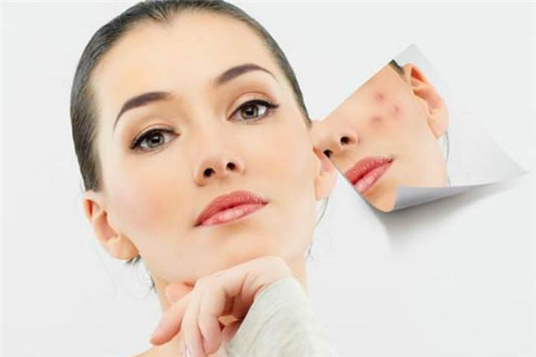 果酸换肤会结痂吗，果酸换肤后抠掉痂皮会留疤吗