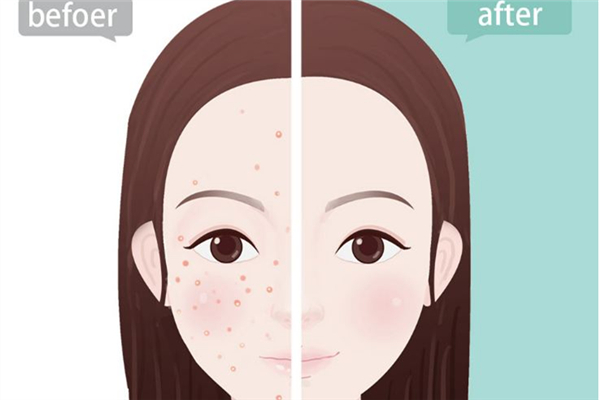 果酸换肤多少钱，果酸换肤的功效和作用