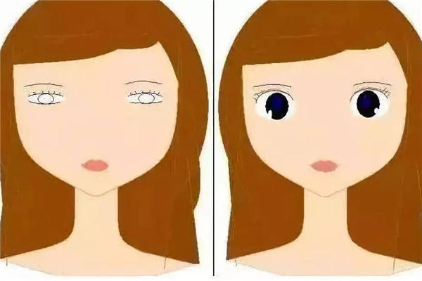 双眼皮手术后注意事项有哪些，双眼皮手术后可以吃什么