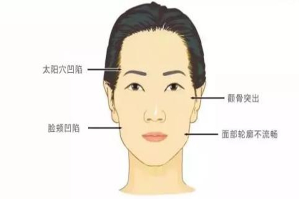 自体填充是什么意思，自体脂肪填充后摸起来硬硬的