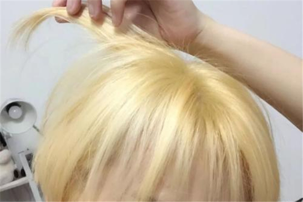 漂发后头皮结痂用什么药，漂发后头皮结痂会秃吗