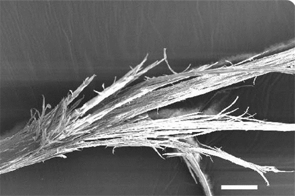头发有分叉怎么办，头发有分叉怎么护理
