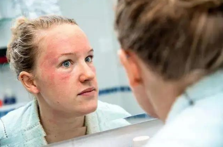 安娜柏林双层芦荟修护精华，拯救你的危肌