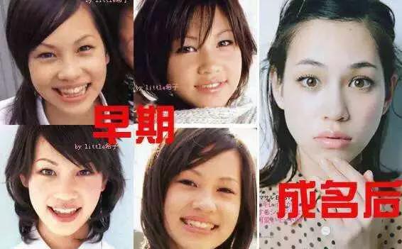 日式整容和韩式整容有什么区别，极致美与自然美