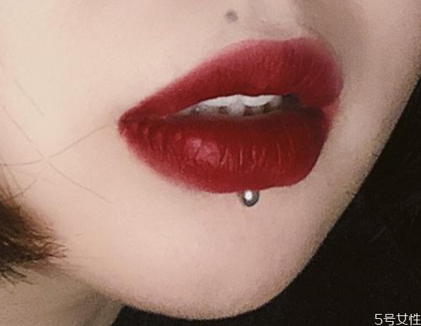 舌钉周围一圈白色，舌钉增生了怎么去除