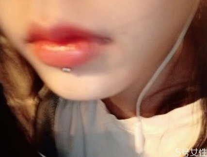 唇钉洞发臭怎么办，唇钉怎么护理