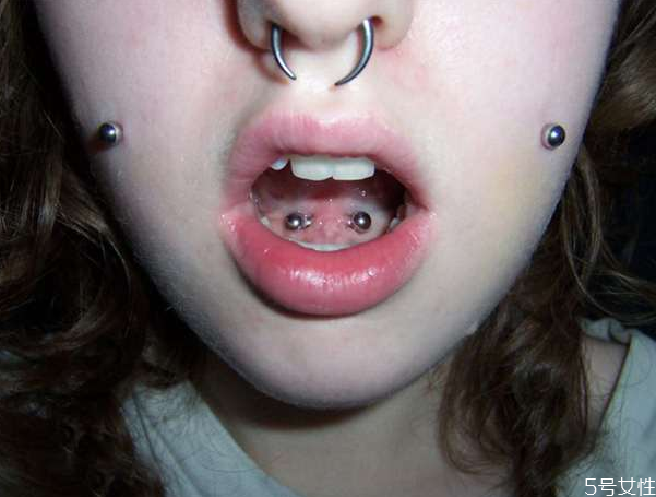 打舌钉疼的厉害不，打舌钉有没有危害