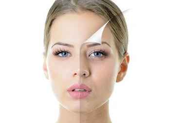 脸上长斑怎么内调效果好，祛斑最有效的8个偏方